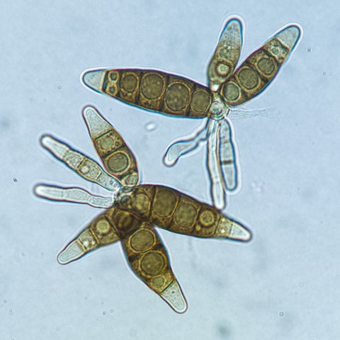 Två konidier (asexuellt bildade sporer) av sporsäcksvampen Prosthemium betulinum. Foto: Roger Andersson