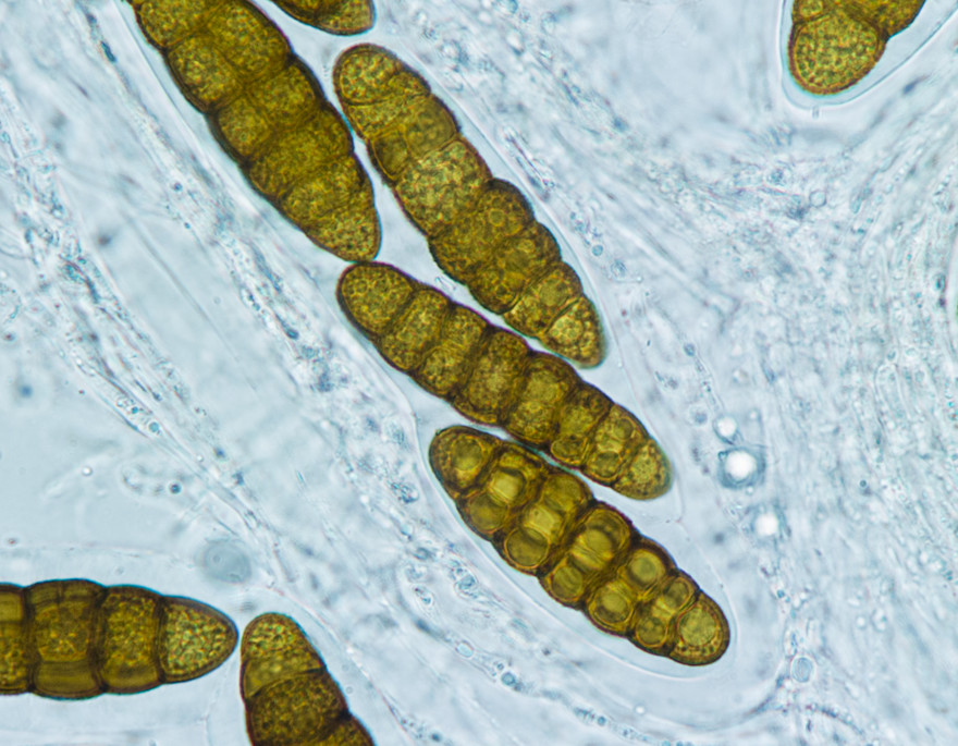 Sexuellt bildade sporer (askosporer) hos Prosthemium betulinum. En sporsäck sträcker sig in från bildens överkant med toppen nära det nedre högra hörnet. Sporerna är försedda med geléhölje. Foto: Roger Andersson